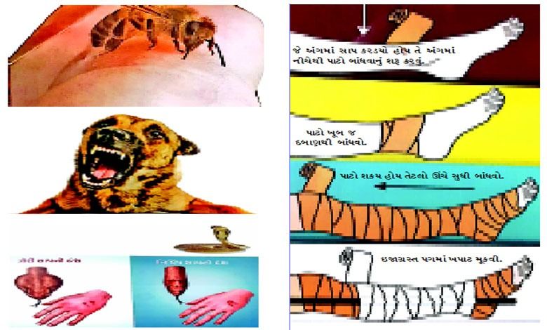 આરોગ્ય પ્લસઃ પ્રાથમિક સારવાર શ્રેણી જીવજંતુઓ તથા પ્રાણીઓના ડંખમાં સારવાર...