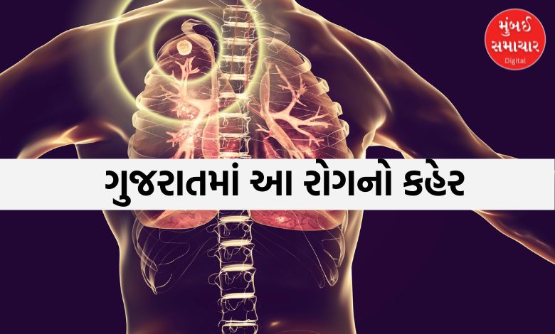 ગુજરાતમાં આ ઘાતક રોગનું નિદાન થયાના એક જ મહિનામાં 59 ટકા દર્દીના મોત
