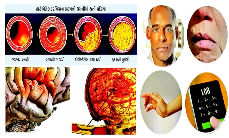 આરોગ્ય પ્લસઃ જીવનનો ધબકાર ચૂકવી દે છે હાર્ટ એટેક...