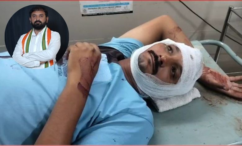 પરેશ ધાનાણીના ભાઈએ યુવકને માથામાં કિટલી મારી કર્યો લોહીલુહાણ, કેટલા ટાંકા આવ્યા ?